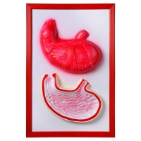 Барельефная модель "Желудок" - «globural.ru» - Саратов