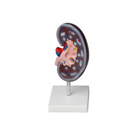 Модель почки в разрезе - «globural.ru» - Саратов