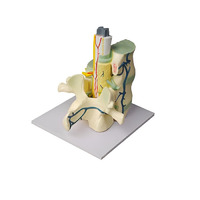 Модель части позвоночника человека - «globural.ru» - Саратов