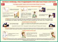 Таблица Порядок действий при опасном кровотечении 1000*1400 винил - «globural.ru» - Саратов