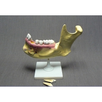 Модель "Челюсть разборная" - «globural.ru» - Саратов