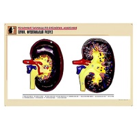 Рельефная таблица "Почка. Фронтальный разрез" (формат А1, матовое ламинир.) - «globural.ru» - Саратов