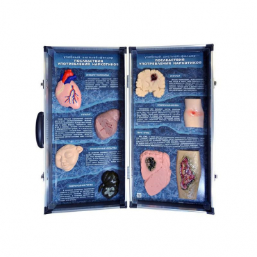 Учебно-демонстрационный кейс "Последствия употребления наркотиков" - «globural.ru» - Саратов